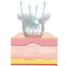 Automatyczne chwytanie skóry