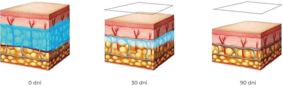 Efekty po 30 i 90 dniach